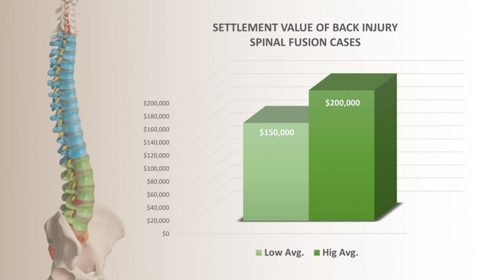 How Much Does A Back Injury Cost A Company